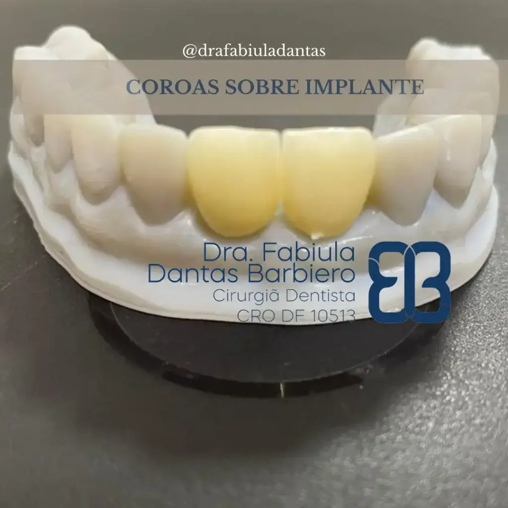Coroasobimplante2 1024x1024